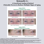 TIGHT AND BRIGHT, an Advanced Gentle Phyto-Retinol and Vitamin C Face Serum, 12 Innovative Technologies, 55% High-Performance Cosmeceuticals - Image 3