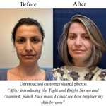 TIGHT AND BRIGHT, an Advanced Gentle Phyto-Retinol and Vitamin C Face Serum, 12 Innovative Technologies, 55% High-Performance Cosmeceuticals - Image 7
