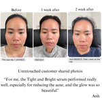 TIGHT AND BRIGHT, an Advanced Gentle Phyto-Retinol and Vitamin C Face Serum, 12 Innovative Technologies, 55% High-Performance Cosmeceuticals - Image 8