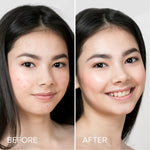 Pimple & Acne Patches - Image 3