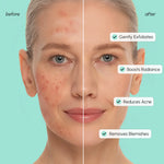 Azelaic Acid Soothing Pads - Image 4