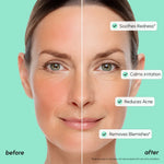 Redness Soothing Azelaic Acid Serum - Image 4