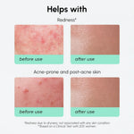 Redness Soothing Azelaic Acid Serum - Image 5