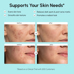 Azelaic Acid Cream for Sensitive Skin - Image 3