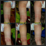 SOOTHE MY SKIN EMU OIL CREAM – Nature’s Healing Power Unleashed! - Image 5