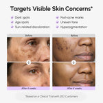 Face & Body Serum for Dark Spots - Image 3