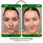 PREMIUM 100% VEGAN HYPER HYDRATOR Face Moisturizer With SPF 30 + Hyaluronic Acid + Lactic acid + Vitamin C + Kombucha - Image 3