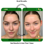 PREMIUM 100% VEGAN Rejuvenating JELLY FACE MASK With Retinol + Turmeric + Aloe Vera + Lactic acid + Rosemary Leaf - Image 3