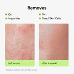 Daily Glow Exfoliating Toner - Image 5