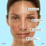 Face Polishing Scrub & Exfoliator - Image 3