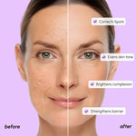 Dark Spot Corrector - Image 4