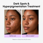 Dark Spot Corrector - Image 5