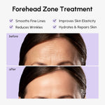 Anti-Wrinkle Forehead Patches - Image 3