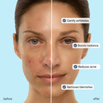 Glow Boost Glycolic Face Toner - Image 4