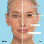 Glycolic Acid Pads 200 PCS - Image 7
