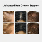 4-in-1 Hair Growth Spray - Image 3
