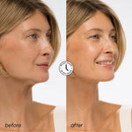 Hyaluronic Acid V-line Lifting Mask - Image 3