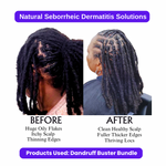 Dandruff Buster Bundle - Image 3