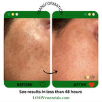 PREMIUM 100% VEGAN GLOW UP Toner Serum With Hyaluronic Acid + Niacinamide + Camellia Leaf + Vitamin E + Rose Water - Image 4