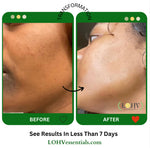 PREMIUM 100% VEGAN GLOW UP Toner Serum With Hyaluronic Acid + Niacinamide + Camellia Leaf + Vitamin E + Rose Water - Image 6