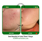 PREMIUM 100% VEGAN Rejuvenating JELLY FACE MASK With Retinol + Turmeric + Aloe Vera + Lactic acid + Rosemary Leaf - Image 9