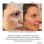 Hyaluron 3D Hydrator Multi Lamellar Emulsion The Advanced Response Face and Neck Cream-Serum with Matrixyl 3000 and Argireline Amplified - Image 3