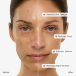 Hydrating Pore Refining Toner - Image 7