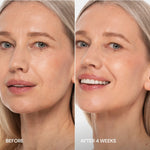 Pro-Retinol Neck Lifting Cream Massager - Image 5
