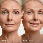 Pro-Retinol Neck Lifting Cream Massager - Image 8