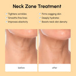 Lifting Neck Wrinkle Patches - Image 3