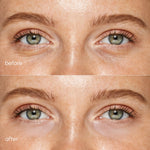 Pink Eye Patches for Puffy Eyes - Image 4