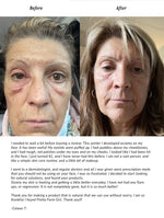 Pure + Simple Skin Kit for Sensitive Skin - Image 4