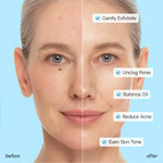 Glycolic & Salicylic Acid Peel Pads - Image 5