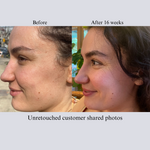 TIGHT AND BRIGHT, an Advanced Gentle Phyto-Retinol and Vitamin C Face Serum, 12 Innovative Technologies, 55% High-Performance Cosmeceuticals - Image 9