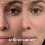4-in-1 Red Light Therapy Wand & Activating Serum Kit - Image 9