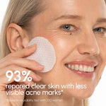 Witch Hazel Clearing Pads - Image 2