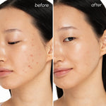 Witch Hazel Clearing Pads - Image 3