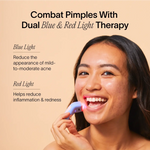 Bye Acne: 3-Minute Pimple Spot Treatment - Image 8